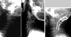 radiografia